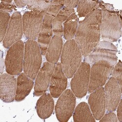 Senataxin Antibody, Novus Biologicals:Antibodies:Primary Antibodies